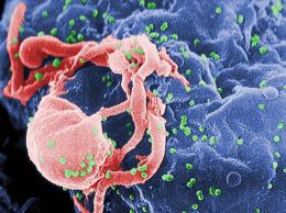 HIV electron picture