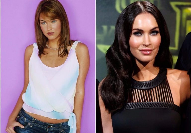 Shocking Before-and-After Celebrity Plastic Surgery