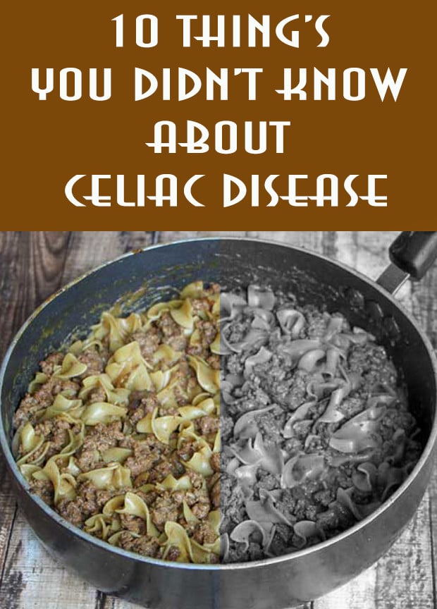 10 things you didn't know about Celiac